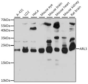 Western Blot: ARL3 Antibody [NBP3-35662] - Western blot analysis of various lysates using ARL3 Rabbit pAb at 1:1000 dilution.Secondary antibody: HRP-conjugated Goat anti-Rabbit IgG (H+L) at 1:10000 dilution.Lysates/proteins: 25ug per lane.Blocking buffer: 3% nonfat dry milk in TBST.Detection: ECL Basic Kit.Exposure time: 30s.