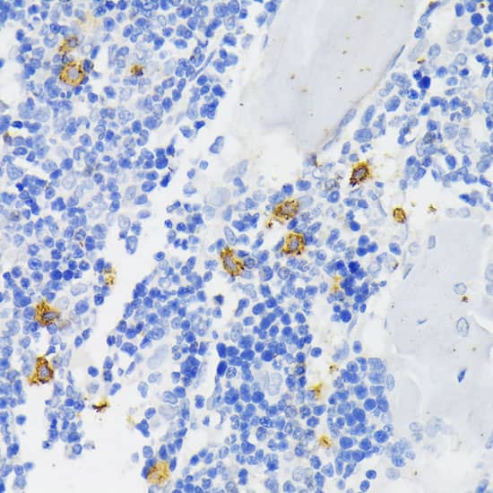 Immunohistochemistry: CYBB/NOX2 Antibody [NBP3-35663] - Immunohistochemistry analysis of paraffin-embedded Rat bone marrow using CYBB/NOX2 Rabbit pAb at dilution of 1:200 (40x lens). Microwave antigen retrieval performed with 0.01M PBS Buffer (pH 7.2) prior to IHC staining.