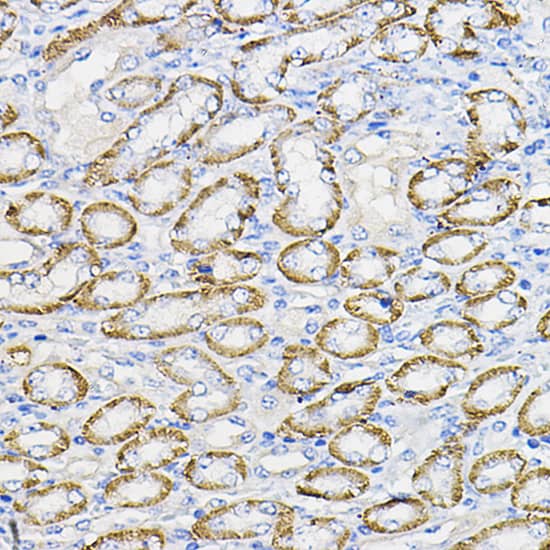 Immunohistochemistry: NUBP1 Antibody [NBP3-35666] - Immunohistochemistry analysis of paraffin-embedded Mouse kidney using NUBP1 Rabbit pAb at dilution of 1:100 (40x lens). High pressure antigen retrieval performed with 0.01M Citrate Bufferr (pH 6.0) prior to IHC staining.