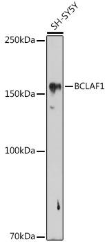 Western Blot: BTF Antibody [NBP3-35671] - Western blot analysis of lysates from SH-SY5Y cells, using BTF Rabbit pAb at 1:1000 dilution.Secondary antibody: HRP-conjugated Goat anti-Rabbit IgG (H+L) at 1:10000 dilution.Lysates/proteins: 25ug per lane.Blocking buffer: 3% nonfat dry milk in TBST.Detection: ECL Basic Kit.Exposure time: 180s.