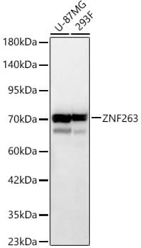 Western Blot: ZNF263 Antibody [NBP3-35673] - Western blot analysis of various lysates, using ZNF263 Rabbit pAb at 1:600 dilution.Secondary antibody: HRP-conjugated Goat anti-Rabbit IgG (H+L) at 1:10000 dilution.Lysates/proteins: 25ug per lane.Blocking buffer: 3% nonfat dry milk in TBST.Detection: ECL Basic Kit.Exposure time: 10s.