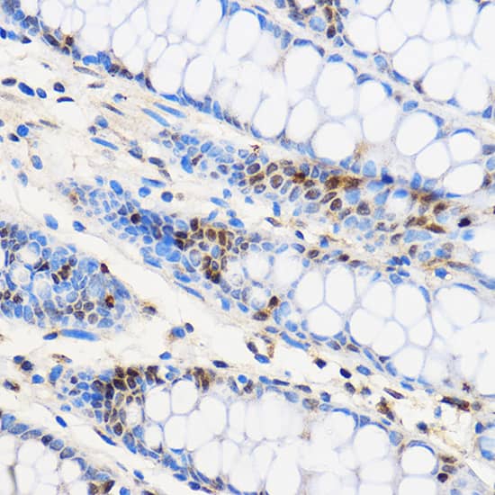 Immunohistochemistry: ZNF263 Antibody [NBP3-35673] - Immunohistochemistry analysis of paraffin-embedded Human colon using ZNF263 Rabbit pAb at dilution of 1:100 (40x lens). Microwave antigen retrieval performed with 0.01M PBS Buffer (pH 7.2) prior to IHC staining.