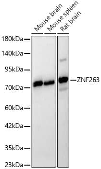 Western Blot: ZNF263 Antibody [NBP3-35673] - Western blot analysis of various lysates, using ZNF263 Rabbit pAb at 1:600 dilution.Secondary antibody: HRP-conjugated Goat anti-Rabbit IgG (H+L) at 1:10000 dilution.Lysates/proteins: 25ug per lane.Blocking buffer: 3% nonfat dry milk in TBST.Detection: ECL Basic Kit.Exposure time: 10s.