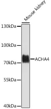 Western Blot: Nicotinic Acetylcholine R alpha 4/CHRNA4 Antibody [NBP3-35674] - Western blot analysis of lysates from mouse kidney, using Nicotinic Acetylcholine R alpha 4/CHRNA4 Rabbit pAb at 1:1000 dilution.Secondary antibody: HRP-conjugated Goat anti-Rabbit IgG (H+L) at 1:10000 dilution.Lysates/proteins: 25ug per lane.Blocking buffer: 3% nonfat dry milk in TBST.Detection: ECL Basic Kit.Exposure time: 60s.