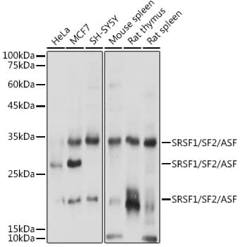 Western Blot: SF2 Antibody [NBP3-35675] - Western blot analysis of various lysates using SF2 Rabbit pAb at 1:1000 dilution.Secondary antibody: HRP-conjugated Goat anti-Rabbit IgG (H+L) at 1:10000 dilution.Lysates/proteins: 25ug per lane.Blocking buffer: 3% nonfat dry milk in TBST.Detection: ECL Basic Kit.Exposure time: 1s.