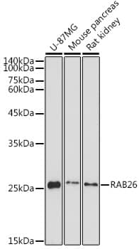 Western Blot RAB26 Antibody