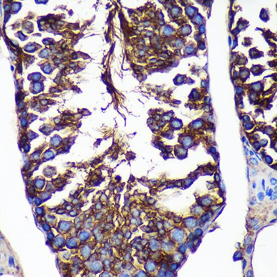 Immunohistochemistry: CTNNA3 Antibody [NBP3-35677] - Immunohistochemistry analysis of paraffin-embedded Mouse testis using CTNNA3 Rabbit pAb at dilution of 1:100 (40x lens). Microwave antigen retrieval performed with 0.01M PBS Buffer (pH 7.2) prior to IHC staining.