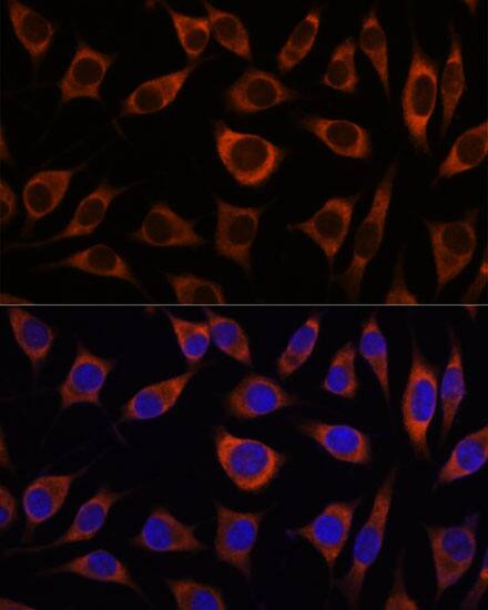 Immunocytochemistry/ Immunofluorescence: CTNNA3 Antibody [NBP3-35677] - Immunofluorescence analysis of L929 cells using CTNNA3 Rabbit pAb at dilution of 1:100. Secondary antibody: Cy3-conjugated Goat anti-Rabbit IgG (H+L) at 1:500 dilution. Blue: DAPI for nuclear staining.