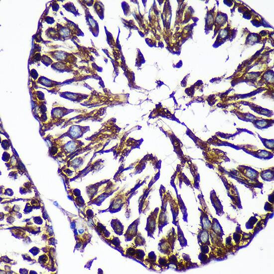 Immunohistochemistry: CTNNA3 Antibody [NBP3-35677] - Immunohistochemistry analysis of paraffin-embedded Rat testis using CTNNA3 Rabbit pAb at dilution of 1:100 (40x lens). Microwave antigen retrieval performed with 0.01M PBS Buffer (pH 7.2) prior to IHC staining.