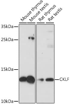 Western Blot: Chemokine-like factor Antibody [NBP3-35678] - Western blot analysis of various lysates using Chemokine-like factor Rabbit pAb at 1:1000 dilution.Secondary antibody: HRP-conjugated Goat anti-Rabbit IgG (H+L) at 1:10000 dilution.Lysates/proteins: 25ug per lane.Blocking buffer: 3% nonfat dry milk in TBST.Detection: ECL Basic Kit.Exposure time: 30s.