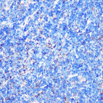 Immunohistochemistry: MST4 Antibody [NBP3-35679] - Immunohistochemistry analysis of paraffin-embedded Mouse spleen using MST4 Rabbit pAb at dilution of 1:100 (40x lens). Microwave antigen retrieval performed with 0.01M PBS Buffer (pH 7.2) prior to IHC staining.