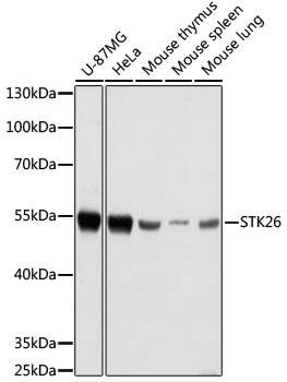 Western Blot: MST4 Antibody [NBP3-35679] - Western blot analysis of various lysates using MST4 Rabbit pAb at 1:1000 dilution.Secondary antibody: HRP-conjugated Goat anti-Rabbit IgG (H+L) at 1:10000 dilution.Lysates/proteins: 25ug per lane.Blocking buffer: 3% nonfat dry milk in TBST.Detection: ECL Basic Kit.Exposure time: 10s.