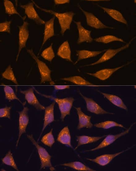 Immunocytochemistry/ Immunofluorescence: ACBD3 Antibody [NBP3-35682] - Immunofluorescence analysis of L929 cells using ACBD3 Rabbit pAb at dilution of 1:100. Secondary antibody: Cy3-conjugated Goat anti-Rabbit IgG (H+L) at 1:500 dilution. Blue: DAPI for nuclear staining.