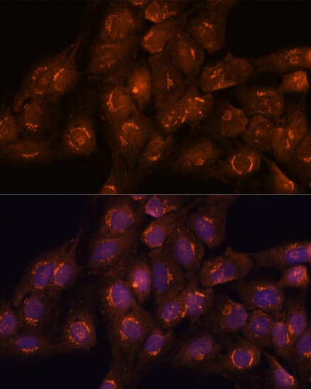 Immunocytochemistry/ Immunofluorescence: ACBD3 Antibody [NBP3-35682] - Immunofluorescence analysis of C6 cells using ACBD3 Rabbit pAb at dilution of 1:100. Secondary antibody: Cy3-conjugated Goat anti-Rabbit IgG (H+L) at 1:500 dilution. Blue: DAPI for nuclear staining.