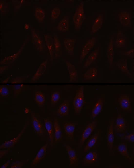 Immunocytochemistry/ Immunofluorescence: PCM1 Antibody [NBP3-35686] - Immunofluorescence analysis of U2OS cells using PCM1 Rabbit pAb at dilution of 1:200 (40x lens). Secondary antibody: Cy3-conjugated Goat anti-Rabbit IgG (H+L) at 1:500 dilution. Blue: DAPI for nuclear staining.