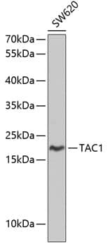 Western Blot: Preprotachykinin-1 Antibody [NBP3-35689] - Western blot analysis of lysates from SW620 cells, using Preprotachykinin-1 Rabbit pAb at 1:1000 dilution.Secondary antibody: HRP-conjugated Goat anti-Rabbit IgG (H+L) at 1:10000 dilution.Lysates/proteins: 25ug per lane.Blocking buffer: 3% nonfat dry milk in TBST.Detection: ECL Basic Kit.Exposure time: 90s.