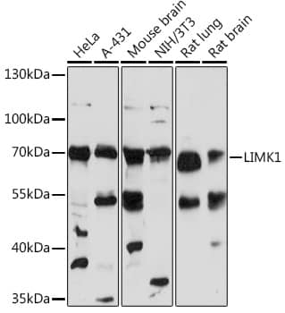 Western Blot: LIM Kinase 1 Antibody [NBP3-35690] - Western blot analysis of various lysates using LIM Kinase 1 Rabbit pAb at 1:1000 dilution.Secondary antibody: HRP-conjugated Goat anti-Rabbit IgG (H+L) at 1:10000 dilution.Lysates/proteins: 25ug per lane.Blocking buffer: 3% nonfat dry milk in TBST.Detection: ECL Basic Kit.Exposure time: 60s.