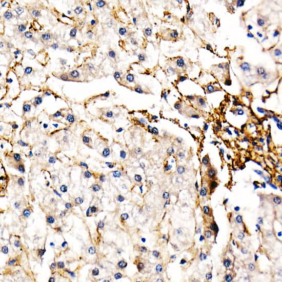 Immunohistochemistry: Fibrillin 1 Antibody [NBP3-35691] - Immunohistochemistry analysis of paraffin-embedded Human liver using Fibrillin 1 Rabbit pAb at dilution of 1:50 (40x lens). High pressure antigen retrieval performed with 0.01M Citrate Bufferr (pH 6.0) prior to IHC staining.