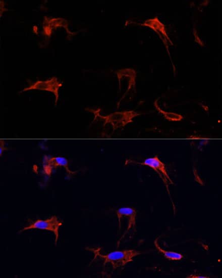 Immunocytochemistry/ Immunofluorescence: Fibrillin 1 Antibody [NBP3-35691] - Immunofluorescence analysis of C6 cells using Fibrillin 1 Rabbit pAb at dilution of 1:100 (40x lens). Secondary antibody: Cy3-conjugated Goat anti-Rabbit IgG (H+L) at 1:500 dilution. Blue: DAPI for nuclear staining.