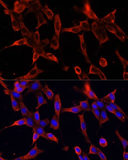 Immunocytochemistry/ Immunofluorescence: Fibrillin 1 Antibody [NBP3-35691] - Immunofluorescence analysis of NIH-3T3 cells using Fibrillin 1 Rabbit pAb at dilution of 1:100 (40x lens). Secondary antibody: Cy3-conjugated Goat anti-Rabbit IgG (H+L) at 1:500 dilution. Blue: DAPI for nuclear staining.