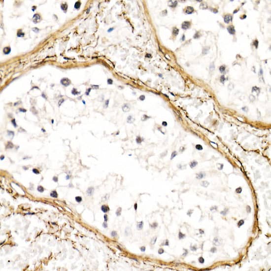 Immunohistochemistry: Fibrillin 1 Antibody [NBP3-35691] - Immunohistochemistry analysis of paraffin-embedded Human testis using Fibrillin 1 Rabbit pAb at dilution of 1:50 (40x lens). High pressure antigen retrieval performed with 0.01M Citrate Bufferr (pH 6.0) prior to IHC staining.