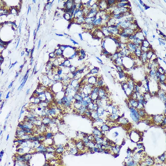 Immunohistochemistry NKIAMRE Antibody