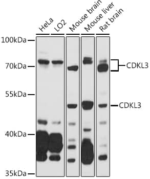 Western Blot NKIAMRE Antibody