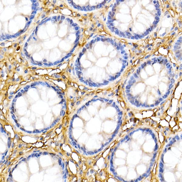 Immunohistochemistry: Decorin Antibody [NBP3-35694] - Immunohistochemistry analysis of paraffin-embedded Human colon using Decorin Rabbit pAb at dilution of 1:50 (40x lens). High pressure antigen retrieval performed with 0.01M Citrate Bufferr (pH 6.0) prior to IHC staining.