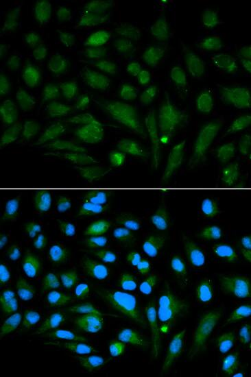 Immunocytochemistry/ Immunofluorescence: Decorin Antibody [NBP3-35694] - Immunofluorescence analysis of MCF-7 cells using Decorin Rabbit pAb. Secondary antibody: Cy3-conjugated Goat anti-Rabbit IgG (H+L) at 1:500 dilution. Blue: DAPI for nuclear staining.