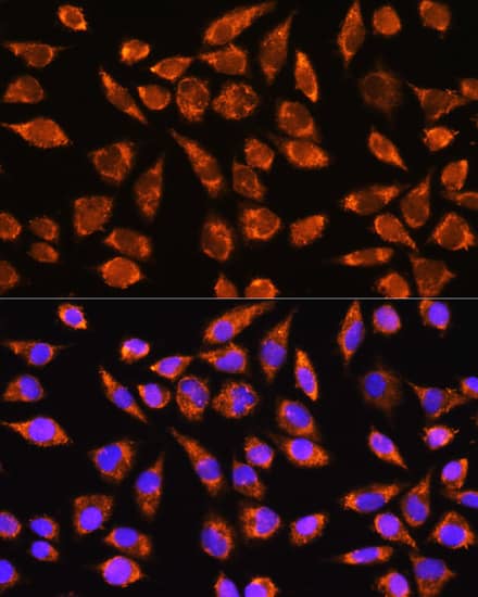 Immunocytochemistry/ Immunofluorescence: MARK2 Antibody [NBP3-35695] - Immunofluorescence analysis of L929 cells using MARK2 Rabbit pAb at dilution of 1:100. Blue: DAPI for nuclear staining.