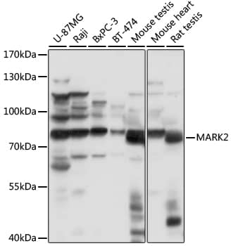 Western Blot: MARK2 Antibody [NBP3-35695] - Western blot analysis of various lysates using MARK2 Rabbit pAb at 1:1000 dilution.Secondary antibody: HRP-conjugated Goat anti-Rabbit IgG (H+L) at 1:10000 dilution.Lysates/proteins: 25ug per lane.Blocking buffer: 3% nonfat dry milk in TBST.Detection: ECL Basic Kit.Exposure time: 1s.