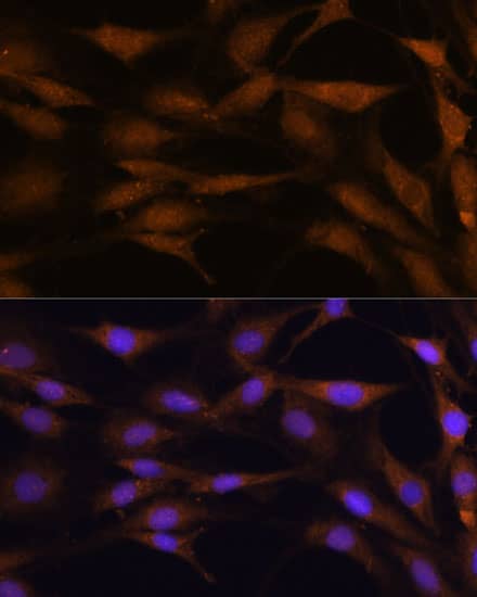 Immunocytochemistry/ Immunofluorescence: TFAP4 Antibody [NBP3-35696] - Immunofluorescence analysis of C6 cells using [KO Validated] TFAP4 Rabbit pAb at dilution of 1:100. Secondary antibody: Cy3-conjugated Goat anti-Rabbit IgG (H+L) at 1:500 dilution. Blue: DAPI for nuclear staining.