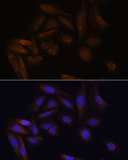 Immunocytochemistry/ Immunofluorescence: TFAP4 Antibody [NBP3-35696] - Immunofluorescence analysis of U-2 OS cells using [KO Validated] TFAP4 Rabbit pAb at dilution of 1:100. Secondary antibody: Cy3-conjugated Goat anti-Rabbit IgG (H+L) at 1:500 dilution. Blue: DAPI for nuclear staining.