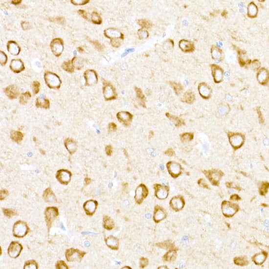 Immunohistochemistry USP18 Antibody