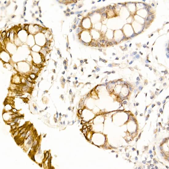 Immunohistochemistry USP18 Antibody