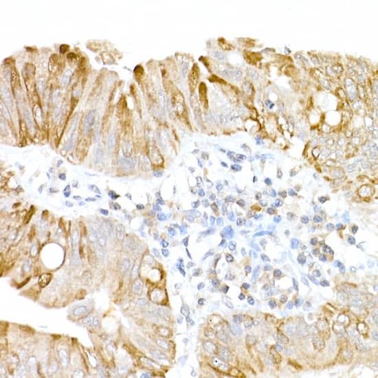 Immunohistochemistry USP18 Antibody