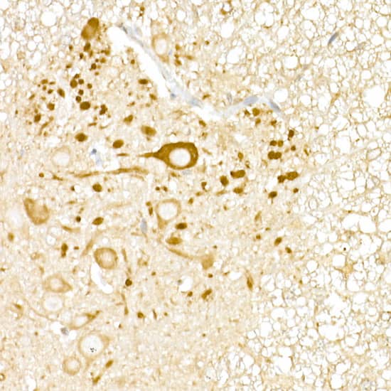 Immunohistochemistry: USP18 Antibody [NBP3-35697] - Immunohistochemistry analysis of paraffin-embedded Mouse spinal cord using USP18 Rabbit pAb at dilution of 1:20 (40x lens). High pressure antigen retrieval performed with 0.01M Citrate Bufferr (pH 6.0) prior to IHC staining.