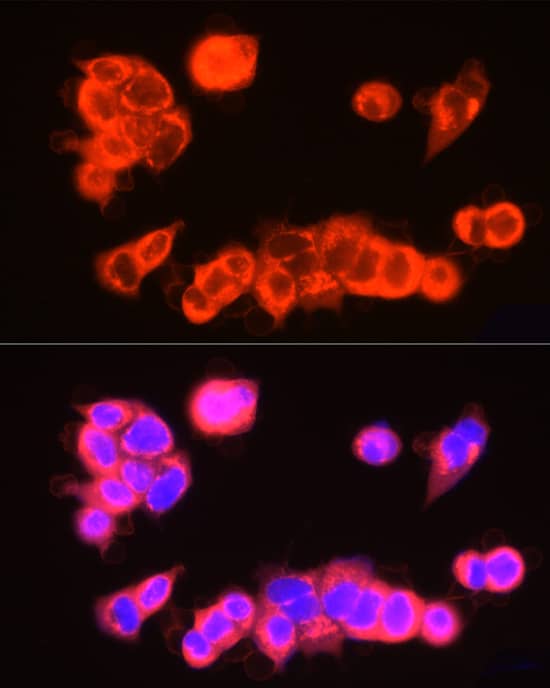 Immunocytochemistry/ Immunofluorescence: USP18 Antibody [NBP3-35697] - Immunofluorescence analysis of MCF7 cells using USP18 Rabbit pAb at dilution of 1:200 (40x lens). Secondary antibody: Cy3-conjugated Goat anti-Rabbit IgG (H+L) at 1:500 dilution. Blue: DAPI for nuclear staining.