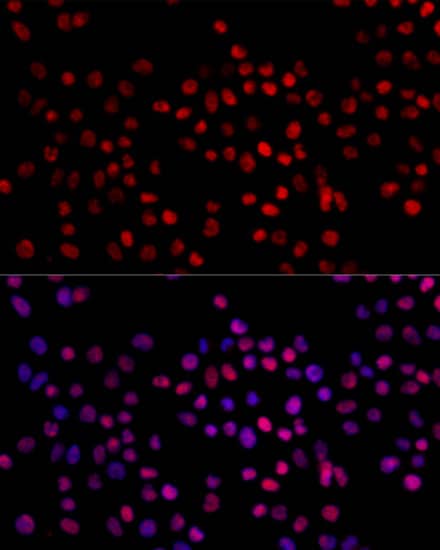 Immunocytochemistry/ Immunofluorescence: XRCC4 Antibody [NBP3-35698] - Immunofluorescence analysis of 293T cells using XRCC4 Rabbit pAb at dilution of 1:100. Blue: DAPI for nuclear staining.