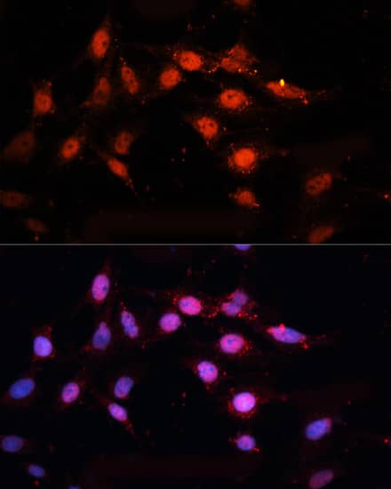 Immunocytochemistry/ Immunofluorescence: CTBP2 Antibody [NBP3-35701] - Immunofluorescence analysis of C6 cells using CTBP2 Rabbit pAb at dilution of 1:100. Secondary antibody: Cy3-conjugated Goat anti-Rabbit IgG (H+L) at 1:500 dilution. Blue: DAPI for nuclear staining.