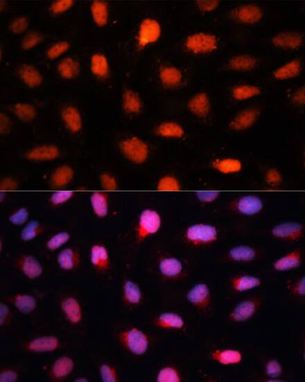 Immunocytochemistry/ Immunofluorescence: CTBP2 Antibody [NBP3-35701] - Immunofluorescence analysis of U2OS cells using CTBP2 Rabbit pAb at dilution of 1:100. Secondary antibody: Cy3-conjugated Goat anti-Rabbit IgG (H+L) at 1:500 dilution. Blue: DAPI for nuclear staining.