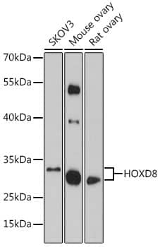 Western Blot: HOXD8 Antibody [NBP3-35703] - Western blot analysis of various lysates using HOXD8 Rabbit pAb at 1:1000 dilution.Secondary antibody: HRP-conjugated Goat anti-Rabbit IgG (H+L) at 1:10000 dilution.Lysates/proteins: 25ug per lane.Blocking buffer: 3% nonfat dry milk in TBST.Detection: ECL Basic Kit.Exposure time: 1s.