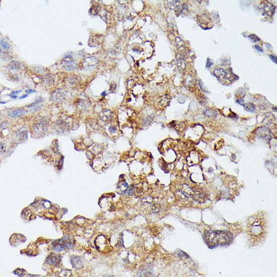 Immunohistochemistry MEKK4 Antibody