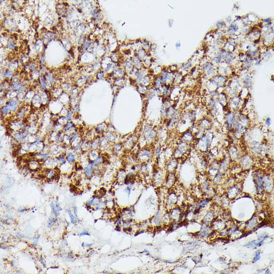 Immunohistochemistry MEKK4 Antibody