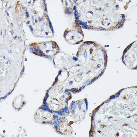 Immunohistochemistry: MEKK4 Antibody [NBP3-35705] - Immunohistochemistry analysis of paraffin-embedded Human placenta using MEKK4 Rabbit pAb at dilution of 1:100 (40x lens). Microwave antigen retrieval performed with 0.01M PBS Buffer (pH 7.2) prior to IHC staining.