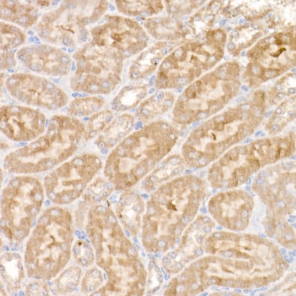 Immunohistochemistry: Ndufs1 Antibody [NBP3-35706] - Immunohistochemistry analysis of paraffin-embedded Mouse kidney using Ndufs1 Rabbit pAb at dilution of 1:50 (40x lens). High pressure antigen retrieval performed with 0.01M Citrate Bufferr (pH 6.0) prior to IHC staining.