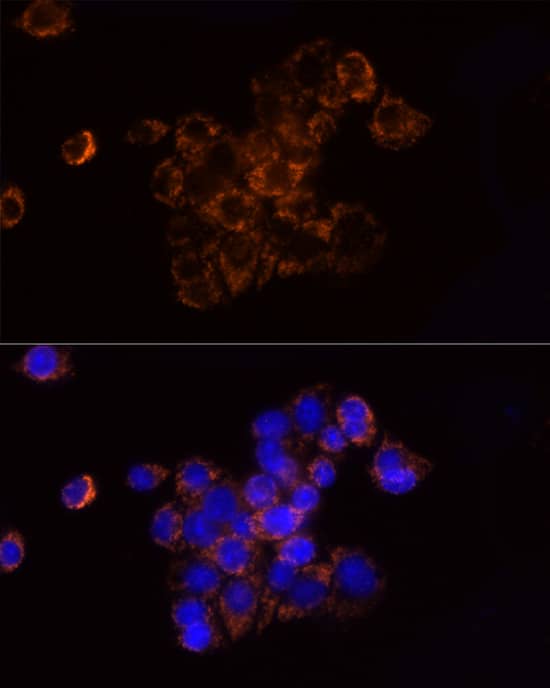 Immunocytochemistry/ Immunofluorescence: Ndufs1 Antibody [NBP3-35706] - Immunofluorescence analysis of HepG2 cells using Ndufs1 Rabbit pAb at dilution of 1:50 (40x lens). Secondary antibody: Cy3-conjugated Goat anti-Rabbit IgG (H+L) at 1:500 dilution. Blue: DAPI for nuclear staining.