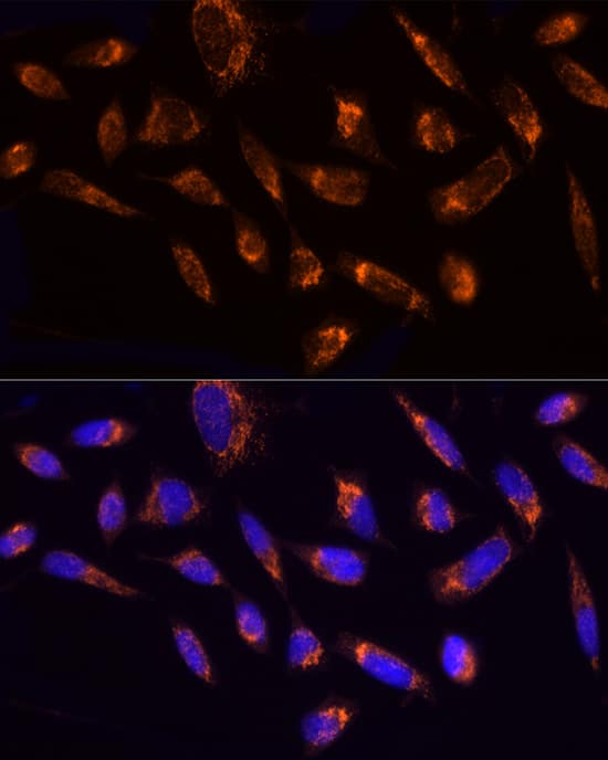 Immunocytochemistry/ Immunofluorescence Ndufs1 Antibody - BSA Free