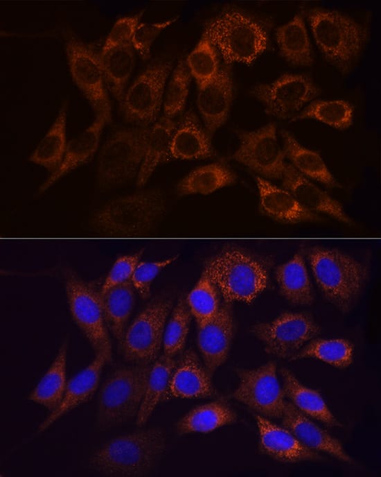 Immunocytochemistry/ Immunofluorescence: Ndufs1 Antibody [NBP3-35706] - Immunofluorescence analysis of NIH/3T3 cells using Ndufs1 Rabbit pAb at dilution of 1:50 (40x lens). Secondary antibody: Cy3-conjugated Goat anti-Rabbit IgG (H+L) at 1:500 dilution. Blue: DAPI for nuclear staining.