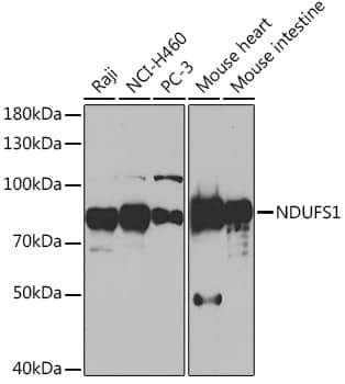 Western Blot: Ndufs1 Antibody [NBP3-35706] - Western blot analysis of various lysates using Ndufs1 Rabbit pAb at 1:1000 dilution.Secondary antibody: HRP-conjugated Goat anti-Rabbit IgG (H+L) at 1:10000 dilution.Lysates/proteins: 25ug per lane.Blocking buffer: 3% nonfat dry milk in TBST.Detection: ECL Basic Kit.Exposure time: 90s.